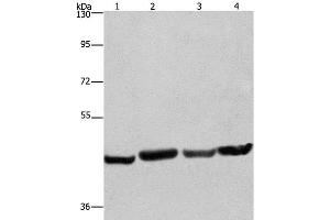 Western Blot analysis of A549, Hela, PC3 and HepG2 cell using RBMY1A1 Polyclonal Antibody at dilution of 1:360 (RBMY1A1 antibody)