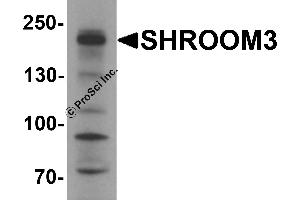 Western Blotting (WB) image for anti-Shroom Family Member 3 (SHROOM3) antibody (ABIN1077407) (SHROOM3 antibody)