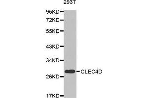 Western blot analysis of extracts of 293T cell line, using CLEC4D antibody. (CLEC4D antibody  (AA 39-215))