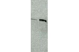 Western Blotting (WB) image for anti-Sup35 (AA 494-507), (PSI+ Prion Phenotype) antibody (ABIN2452140) (Sup35 (AA 494-507), (PSI+ Prion Phenotype) antibody)