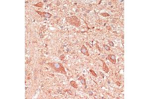 Immunohistochemistry of paraffin-embedded rat brain using G antibody (ABIN7267516) at dilution of 1:100 (40x lens). (GAP43 antibody  (AA 1-238))