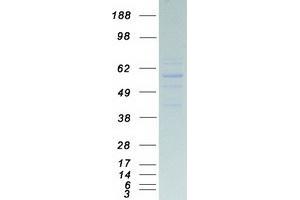 Validation with Western Blot (MT-ATP6 Protein (Myc-DYKDDDDK Tag))