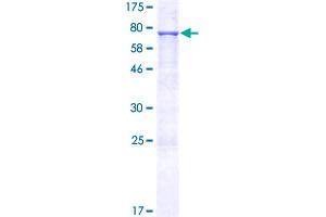 NARFL Protein (AA 1-476) (GST tag)