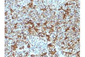 Formalin-fixed, paraffin-embedded human Pancreas stained with Spectrin beta III Monoclonal Antibody (SPTBN2/1583). (Spectrin, Beta, Non-erythrocytic 2 (SPTBN2) (AA 356-475) antibody)