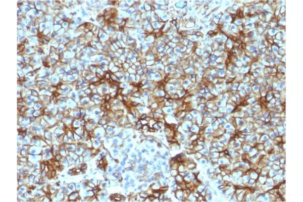 Spectrin, Beta, Non-erythrocytic 2 (SPTBN2) (AA 356-475) antibody