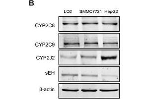 Hcy promoted EET secretion and CYP2J2 upregulation in HCC cellsIntracellular levels of 11,12- and 14,15-EET A.