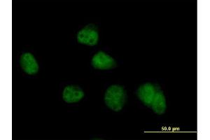 Immunofluorescence of purified MaxPab antibody to COPS8 on HeLa cell. (COPS8 antibody  (AA 1-209))