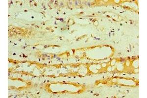 Immunohistochemistry of paraffin-embedded human kidney tissue using ABIN7154317 at dilution of 1:100 (GOPC antibody  (AA 203-462))