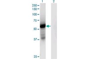 Western Blot analysis of GPT2 expression in transfected 293T cell line by GPT2 monoclonal antibody (M04), clone 7A11. (GPT2 antibody  (AA 358-456))