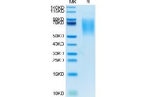 Biotinylated Human CA125 on Tris-Bis PAGE under reduced conditions. (MUC16 Protein (AA 12660-12923) (His-Avi Tag,Biotin))