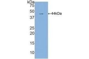 Detection of Recombinant IL6, Human using Monoclonal Antibody to Interleukin 6 (IL6) (IL-6 antibody  (AA 30-212))