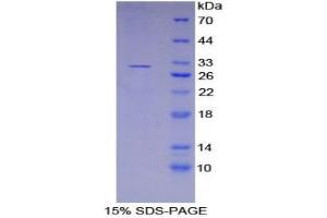 SDS-PAGE analysis of Human Kallikrein 11 Protein. (Kallikrein 11 Protein (KLK11))