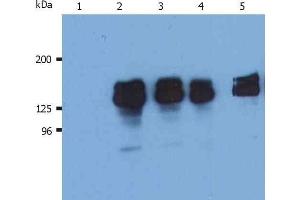 Western Blotting analysis (reducing conditions) of human SHIP-1 in whole cell lysate of THP-1 human acute monocytic leukemia cell line.