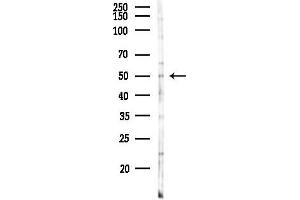 Western blot analysis of lysates from F10-LUC cells(heat-shock 45 min treatment), using TNF Receptor I Antibody at 1/1000 dilution.