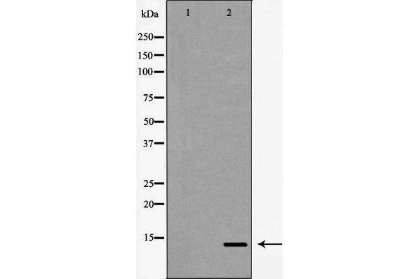 beta Synuclein antibody  (C-Term)