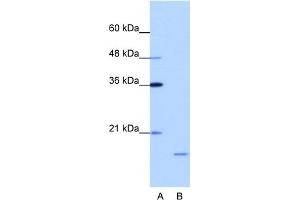 WB Suggested Anti-ISG20 Antibody Titration:  1. (ISG20 antibody  (N-Term))