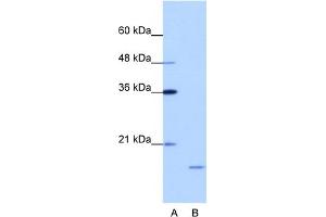 WB Suggested Anti-ISG20 Antibody Titration:  1.