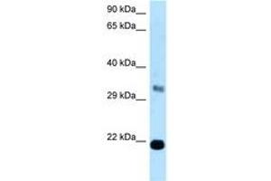 Image no. 1 for anti-FK506 Binding Protein 14, 22 KDa (FKBP14) (C-Term) antibody (ABIN6747894) (FKBP14 antibody  (C-Term))