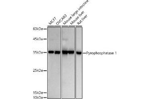 Western blot analysis of extracts of various cell lines, using Pyrophosphatase 1 antibody (ABIN7269762) at 1:500 dilution. (Pyrophosphatase (Inorganic) 1 (PPA1) antibody)