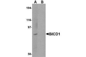 Image no. 1 for anti-Bicaudal D Homolog 1 (BICD1) (C-Term) antibody (ABIN1492179) (BICD1 antibody  (C-Term))