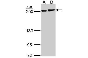 WB Image MYH9 antibody [N1], N-term detects MYH9 protein by Western blot analysis. (Myosin 9 antibody  (N-Term))