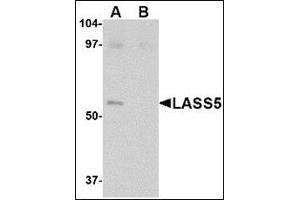 Western blot analysis of LASS5 in SK-N-SH lysate with this product at 1 μg/ml in the (A) absence and (B) presence of blocking peptide. (LASS5 antibody  (C-Term))