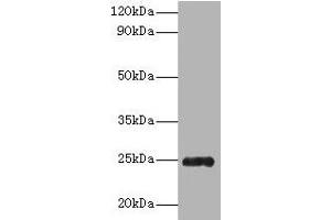 Western blot All lanes: Trypsin antibody at 2 μg/mL + Recombinant Pig Trypsin protein 1 μg Secondary Goat polyclonal to rabbit IgG at 1/10000 dilution Predicted band size: 25 kDa Observed band size: 25 kDa (Trypsin antibody  (AA 9-231))