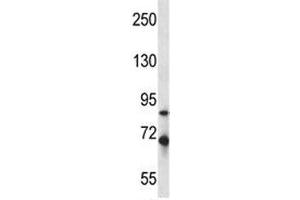Irak1 antibody western blot analysis in mouse Neuro-2a lysate. (IRAK1 antibody  (AA 405-433))
