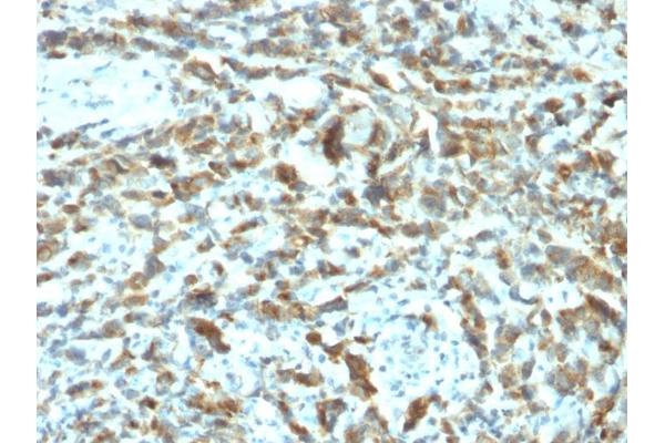 TFF1 antibody