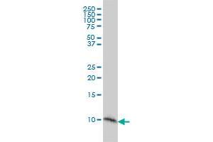Western Blotting (WB) image for anti-S100 Calcium Binding Protein A2 (S100A2) (AA 1-97) antibody (ABIN562762)