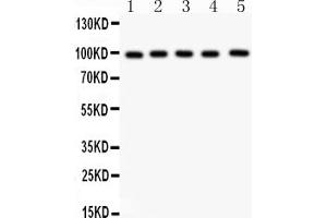 Western blot analysis of ASPH using anti-ASPH antibody (ABIN3043790). (Aspartate beta Hydroxylase antibody  (C-Term))