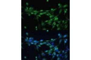 Immunofluorescence analysis of NIH-3T3 cells using Casein Kinase 2 beta (Casein Kinase 2 beta (CSNK2B)) Polyclonal Antibody (ABIN7266104) at dilution of 1:100 (40x lens). (CSNK2B antibody  (AA 1-215))