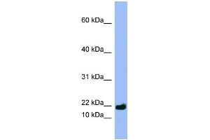 WB Suggested Anti-SPRR3 Antibody Titration:  0. (SPRR3 antibody  (Middle Region))