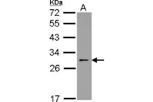 Western Blotting (WB) image for anti-Nucleolar Protein 3 (Apoptosis Repressor with CARD Domain) (NOL3) (AA 1-197) antibody (ABIN1501899) (NOL3 antibody  (AA 1-197))