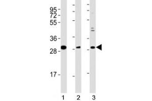 Western blot testing of Nkx2. (NK2 Homeobox 5 antibody  (AA 98-133))