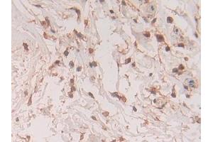 Immunohistochemistry (IHC) image for anti-S100 Calcium Binding Protein A11 (S100A11) (AA 1-105) antibody (ABIN7432079)