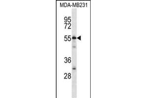 CABIN486182 and ABIN1535563 Antibody (N-term) (ABIN657088 and ABIN2837891) western blot analysis in MDA-M cell line lysates (35 μg/lane). (C7ORF25 antibody  (N-Term))