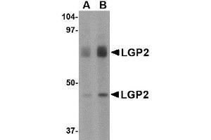 Western blot analysis of LGP2 in rat kidney tissue lysate with LGP2 antibody at (A) 1 and (B) 2 µg/ml.