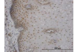 Immunoperoxidase of monoclonal antibody to MBNL1 on formalin-fixed paraffin-embedded human esophagus. (MBNL1 antibody  (AA 1-382))