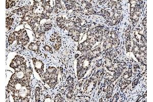 IHC analysis of DBC-1/CCAR2 using anti-DBC-1/CCAR2 antibody (ABIN7602235). (CCAR2 antibody  (AA 65-917))