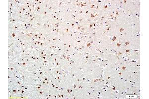 Formalin-fixed and paraffin embedded human brain labeled with Anti-HDAC10 Polyclonal Antibody, Unconjugated (ABIN681298) at 1:200 followed by conjugation to the secondary antibody and DAB staining (HDAC10 antibody  (AA 561-669))