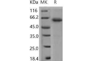 Western Blotting (WB) image for Junctional Adhesion Molecule 2 (JAM2) protein (Fc Tag) (ABIN7321101)