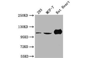 Western Blot Positive WB detected in: 293 whole cell lysate, MCF-7 whole cell lysate, Rat Heart tissue All lanes: ACTN2 antibody at 1:2000 Secondary Goat polyclonal to rabbit IgG at 1/50000 dilution Predicted band size: 104 kDa Observed band size: 104 kDa (ACTN2 antibody  (AA 1-301))