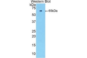 Detection of Recombinant TNNC2, Human using Polyclonal Antibody to Troponin C Type 2, Fast (TNNC2) (TNNC2 antibody  (AA 2-160))