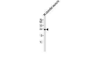 Western blot analysis of lysate from human skeletal muscle tissue lysate, using TME Antibody (N-term) (ABIN6244271 and ABIN6577475). (TMEM239 antibody  (N-Term))