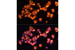 Immunofluorescence analysis of  cells using PRKCB antibody (ABIN6128463, ABIN6146200, ABIN6146202 and ABIN6221544) at dilution of 1:100. (PKC beta antibody  (AA 220-340))