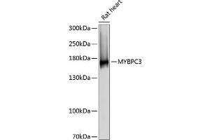 Western blot analysis of extracts of rat heart, using MYBPC3 antibody (ABIN6129601, ABIN6144221, ABIN6144222 and ABIN6215951) at 1:3000 dilution. (MYBPC3 antibody  (AA 200-400))