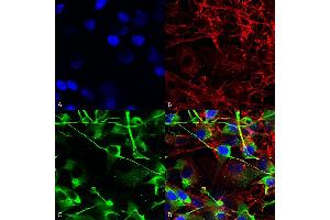 Immunocytochemistry/Immunofluorescence analysis using Mouse Anti-GluN2A/NR2A Monoclonal Antibody, Clone S327-95 (ABIN2483884). (NMDAR2A antibody  (AA 75-325) (PE))