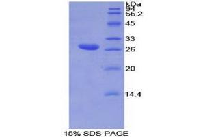 SDS-PAGE (SDS) image for Torsin A Interacting Protein 2 (TOR1AIP2) (AA 250-475) protein (His tag) (ABIN2127040)