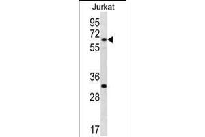 Western blot analysis in Jurkat cell line lysates (35ug/lane).
